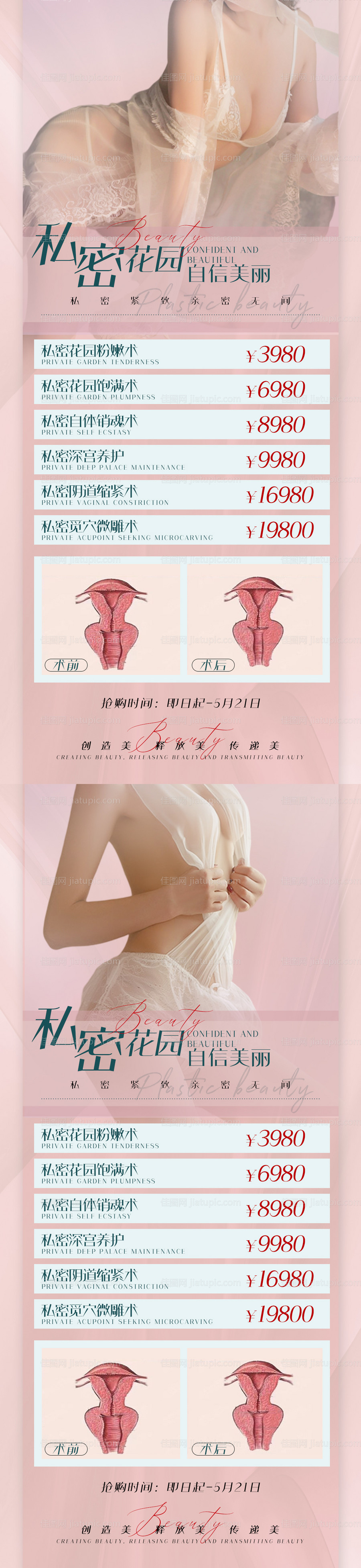 医美女性私密海报-源文件