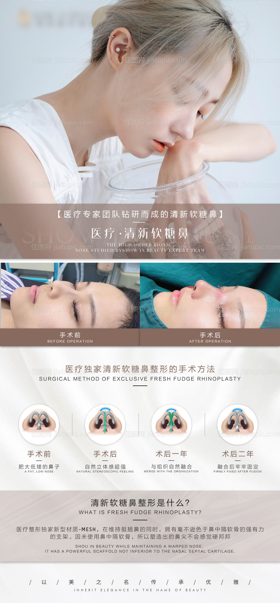 隆鼻介绍海报-源文件