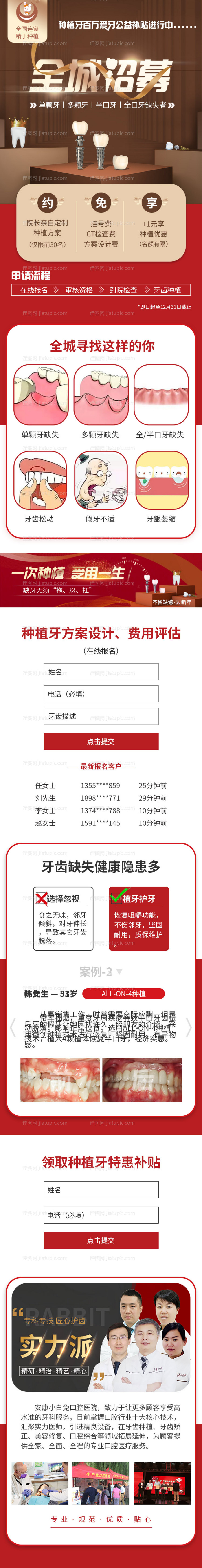 种植牙招募口腔牙齿长图-源文件