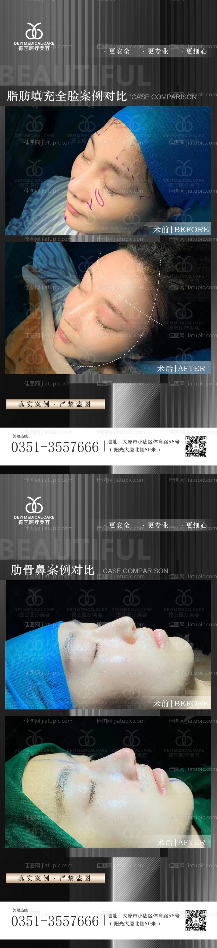 医美案例对比图-源文件