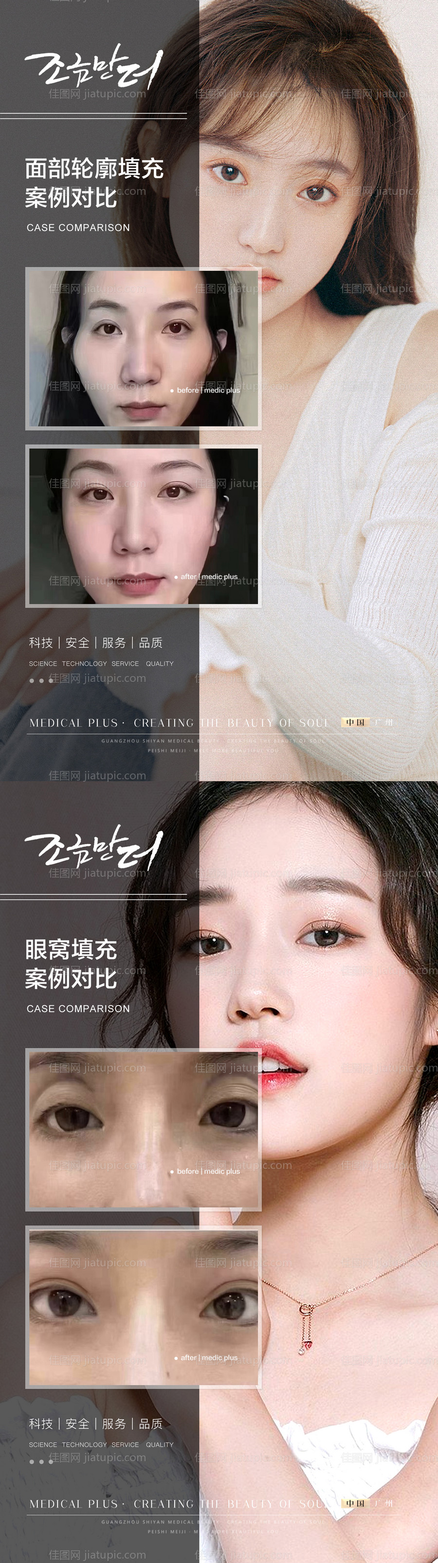 整形真人案例分享集-源文件