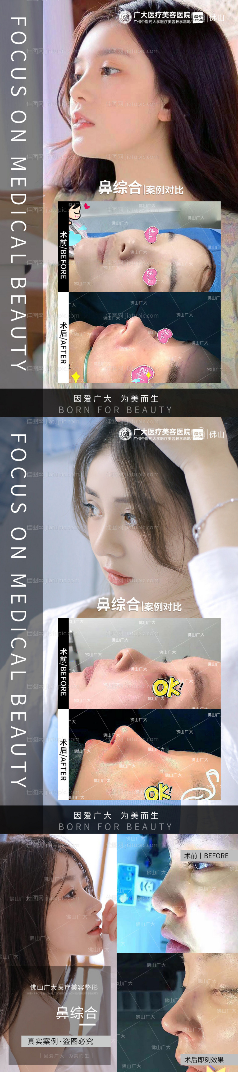 整形真人案例分享集-源文件