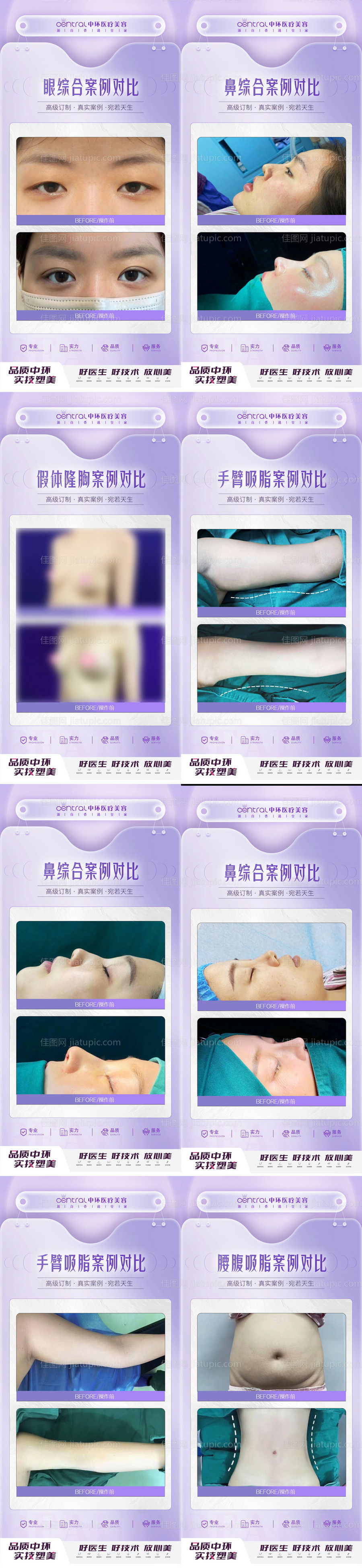 医美整形案例对比-源文件