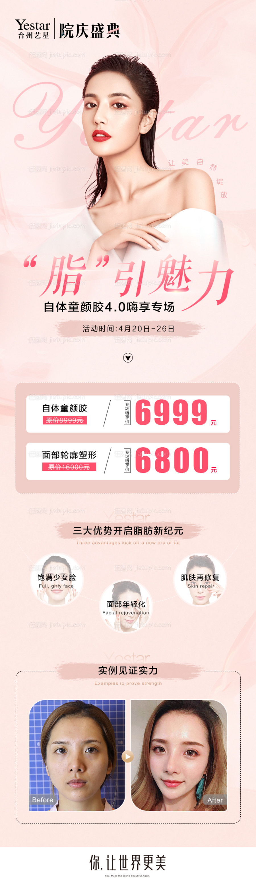 艺星脂肪政策长图-源文件