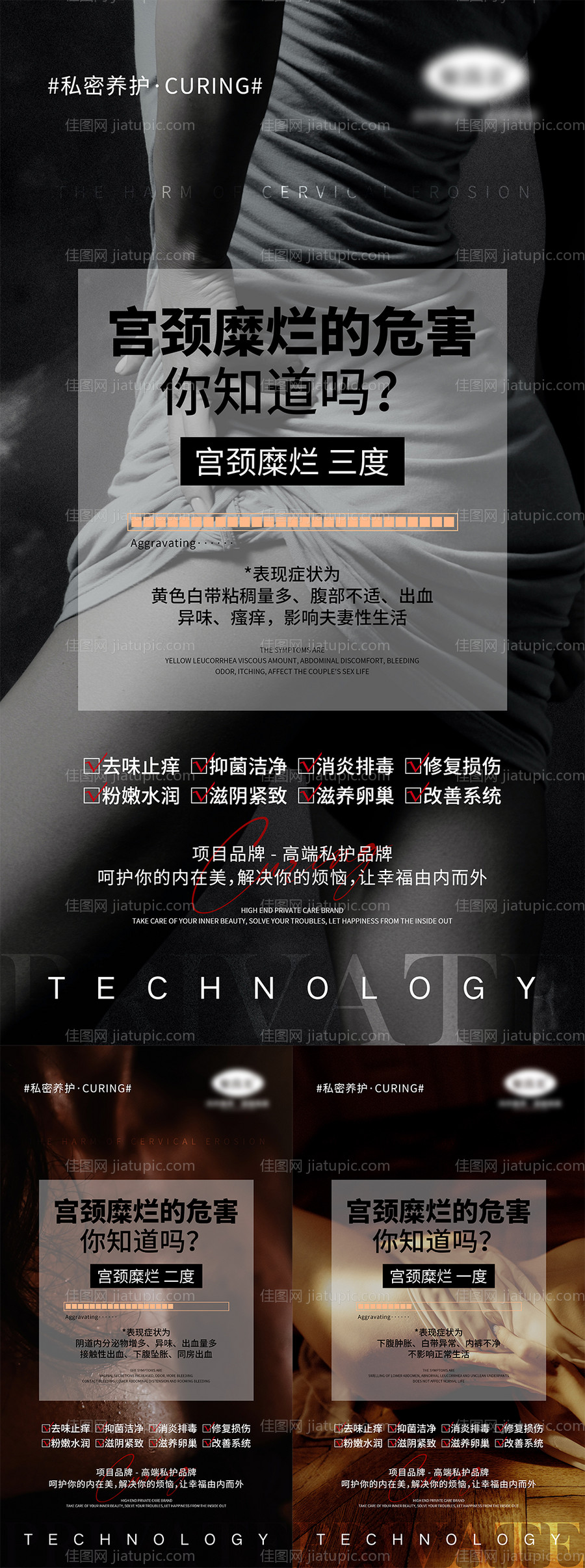 私密妇科疾病宣传系列海报-源文件