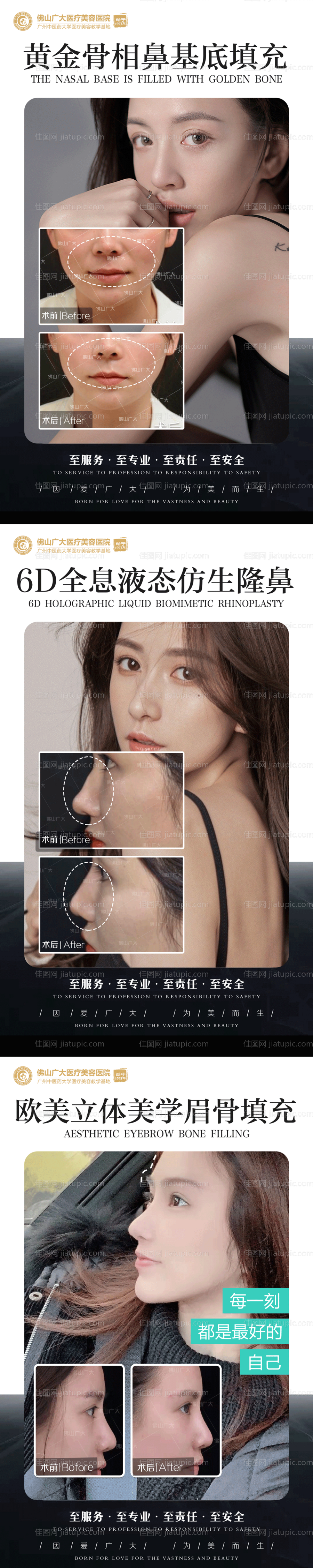 医美鼻基底案例集-源文件