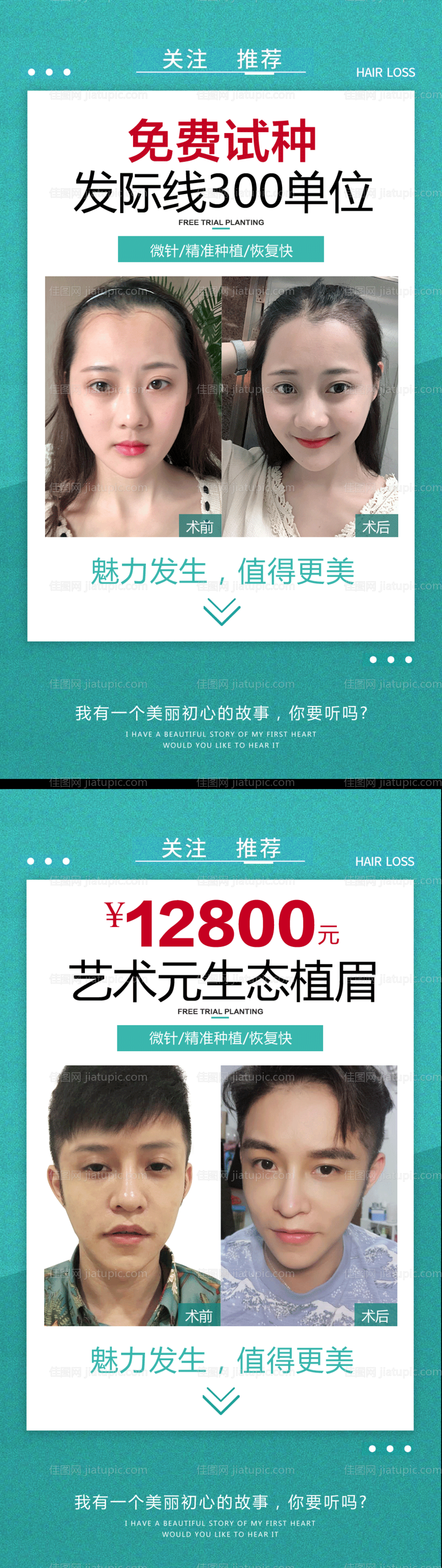 植发案例海报（TIF用PSD打开）-源文件